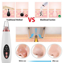 Load image into Gallery viewer, USB blackhead remover face remover vacuum pores skin care acne pores cleanser pimple
